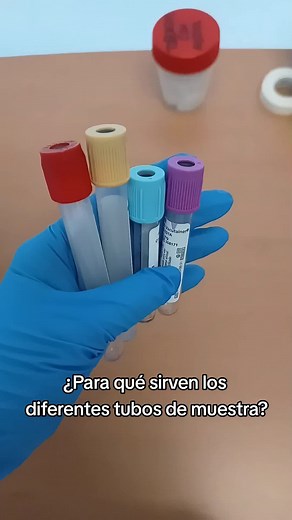 ¿Para qué sirven los diferentes tubos de muestra?
