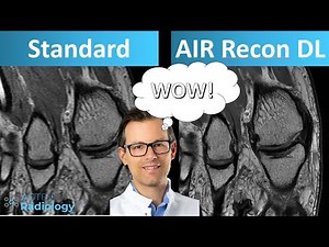 Review: GE AIR Recon DL Image quality for MSK studies