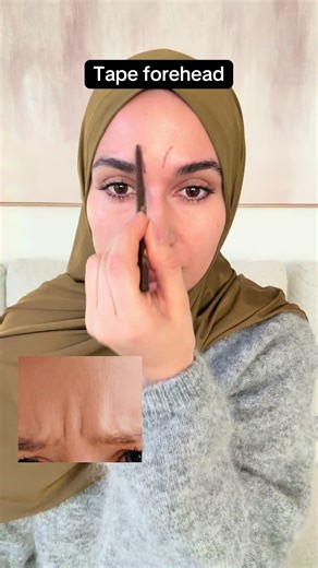 Effective Techniques to Reduce Forehead Wrinkles