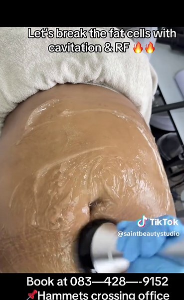 Transform Your Body with RF Sculpting Techniques