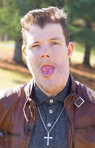 I hid my face for years - Now I'm happy how I am | Born Different