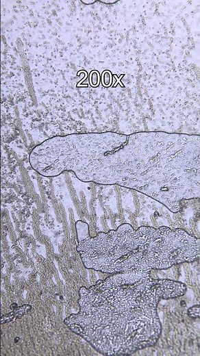 Yogurt Under a Microscope – Hidden Micro World!