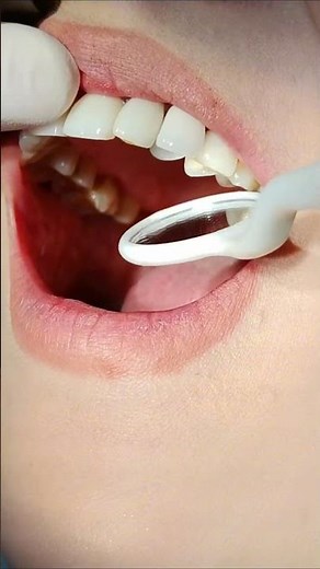 Real teeth vs. Fake teeth#DentalTips #Denture #FalseTooth #DentalRestoration