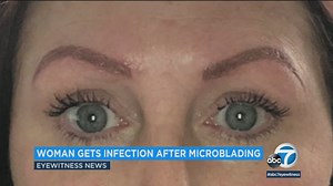 Woman's warning: Microblading eyebrows can lead to infection