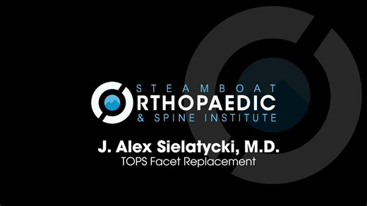TOPS Facet Replacement by SOSI