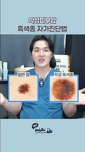 점인줄 알았더니 악성종양!? | 육안으로 구분하기 힘든 피부암 흑색종 자가진단법 공개