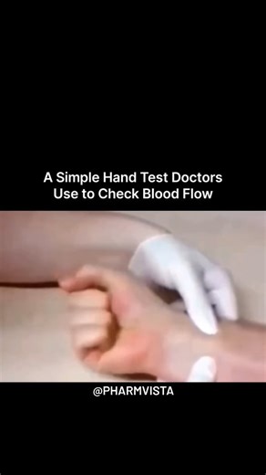 PharmVista Official on Instagram: "This simple bedside test is commonly used to assess blood flow in the hand. By gently compressing the arteries and then releasing them, doctors observe how quickly normal skin color returns. A rapid return indicates healthy circulation, while a delayed response may suggest reduced blood flow or arterial issues. It’s quick, painless, and provides valuable insight into overall vascular health without the need for advanced equipment. Dm for credit and removal... #