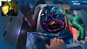 ALIEN SURGERY! Surgeon Simulator 2013 Pewdsball Success