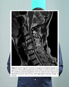 3.1K views · 19 reactions | Do imaging findings matter? When we scan...