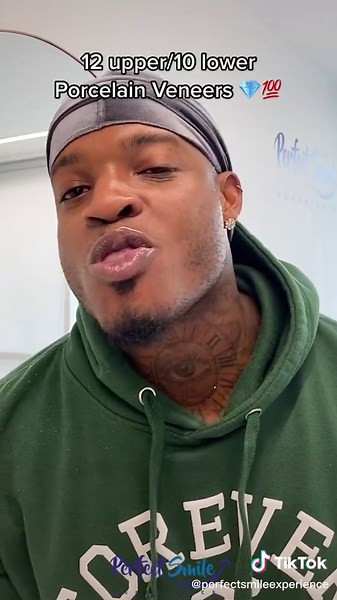 What’s your reason for a Perfect Smile? His girlfriend definitely isn’t leaving him when she sees this awesome smile😂💯. Thanks for visiting from Toronto, Canada 🇨🇦.**Note the minimal shaving technique and gum sculpting to create this smile. 💎#hollywoodsmile #veneers #fypシ #newsmile #exportingsmiles #dentist #cosmeticdentistry #perfectsmile #porcelainveneers #bestdentistever