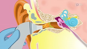 Video: Assessing Body Temperature - Tympanic membrane