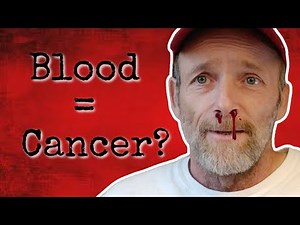 11-16-2021 More Cancer? Stage 4 Colon Cancer vlog~ New chemo side effect~ Diet Changes~ Liver Pain