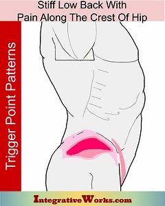 Stiff back, Pain on the Side of the Hip Hip Pain