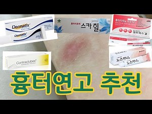 흉터연고 추천 ( 여드름에는 어떤 흉터연고가 좋을까? 흉터별 연고 추천)