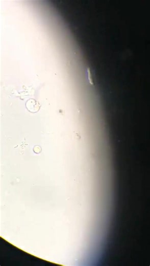 12K views · 123 reactions | Urine sample  #lablife #microbiology | Lab life | Facebook