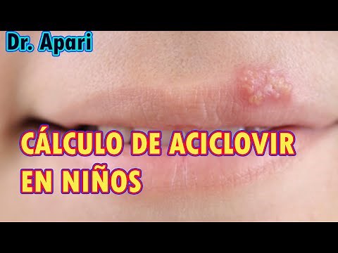 How to calculate the dose of acyclovir in children to treat cold sores