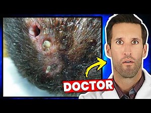 The Most Disturbing Parasites Found Inside Humans