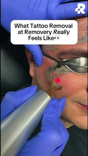 What tattoo removal really feels like...👀 #removery