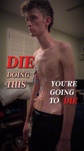 @jdawg.mp4 on Instagram: "Ride like you’re invisible my friends . . . #motorcycle #accident #recovery"