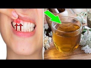 These 5 Effective Home Remedies Will Fix Receding Gums | Natural Health