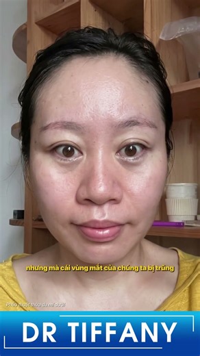Tưởng Lấy Mỡ Mắt Càng Nhiều Càng Gọn Nhưng Sự Thật Là Gì, Có Đúng? #shorts #thammy #catmi
