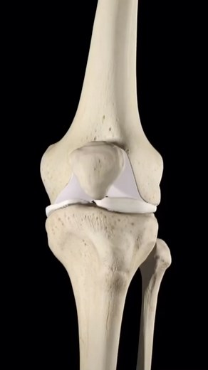 50K views · 33 comments | Total Knee Arthroplasty The primary...
