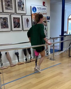 Meet Anna, she’s a newly above-the-knee amputee from Poland, She’s testing out her diagnostic socket and getting a feel for walking once again. Nothing can stop her now! 👍⁣⁣ | A Step Ahead Prosthetics