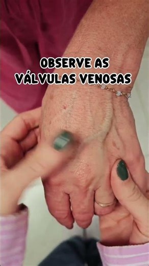Válvulas venosas.
