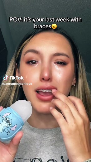 Its so tight😭🦷 #braces #viral #fyp | braces