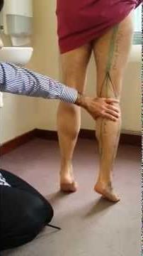 5. LL Sacral Plexus - Tibial nerve