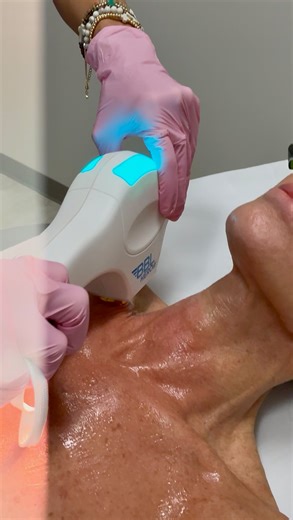 Sun spots, redness, uneven tone? BBL laser is a go-to for targeting pigmentation on the face, neck, chest, and more. If your skin could use a refresh, this treatment delivers. Book your BBL laser appointment today! 📍 The Skin Care Center | Pensacola, FL 📞 Call or text 850.474.0155 to schedule — Meet Our Providers Lisa Williams, APRN @lisawnp Amanda Davis, ARNP @amanda_davis_arnp Chantel Desporte, FNP-BC @ChantelD_theinjectorNP Alice Bohannon, PhD, ARNP @alicebphd_arnp Alexandria Gianinni, FNP-