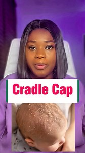 5.5K views · 53 reactions | Know the common causes and symptoms of cradle cap in babies with the home remedies. Borat Medicals | Borat Medicals | Facebook