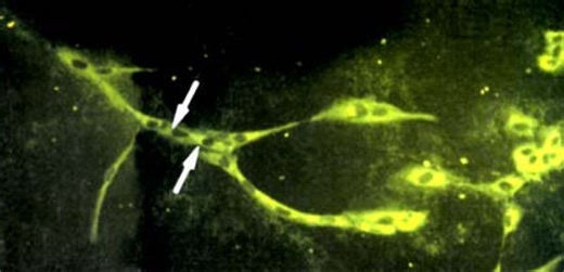 Comprendre l'angiogenèse  | IVS, l'Institut des Vaisseaux et du Sang