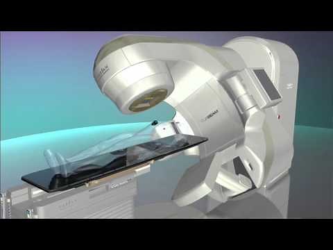 Radiation Therapy: Better Care in Less Time