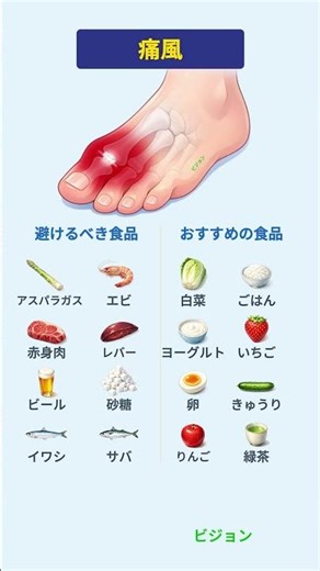 避けるべき食品 VS おすすめの食品：痛風