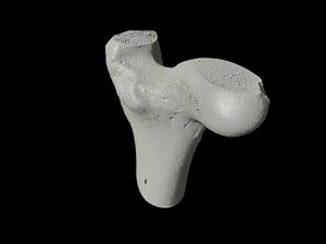 Trabecular and cortical bone revealed by DRAGONFLY