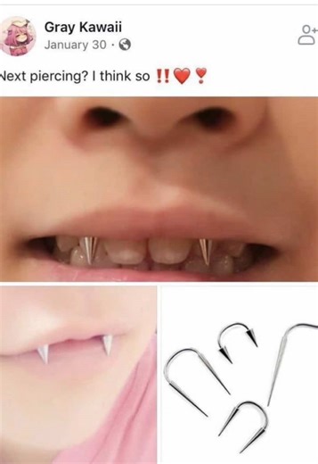 Tips to Prevent Gum Damage from Smile Piercings
