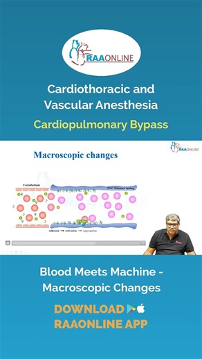 CTVA - Blood Meets Machine - Coagulation conundrum - Macroscopic changes