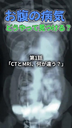 お腹の病気、どうやって見つける？ ①「CTとMRI、何が違う？」#消化器内科 #CT検査 #MRI検査 #画像診断 #肝臓 #胆嚢 #膵臓 #医療解説 #shorts