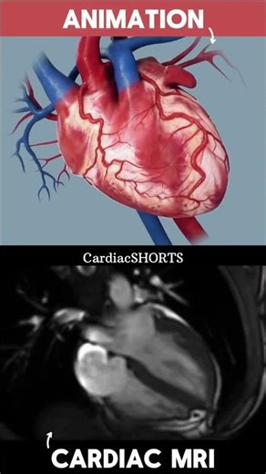 Cardiac MRI vs. 3D Animation: Side-by-Side Comparison #shorts #vs #MRI #cardiology