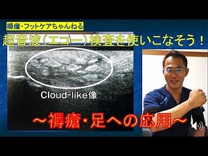 Mastering ultrasound (echo) testing! Application to pressure ulcers and feet!