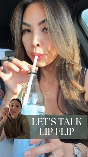 𝐅𝐨𝐫𝐮𝐦 𝐏𝐚𝐭𝐞𝐥, 𝐌𝐃, 𝐅𝐀𝐀𝐃 | Thinking about a Lip Flip with Botox? Here’s what you should know… A Botox lip flip is a subtle, natural-looking way to enhance your upper... | Instagram