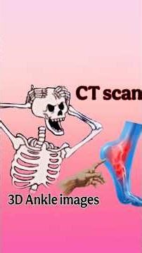 3D Ankle CT scan #cect #anatomy #ct #mri