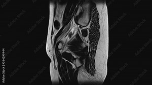 MRI of the female pelvic organs, abdominal cavity, gastrointestinal tract and bladder Stock Video