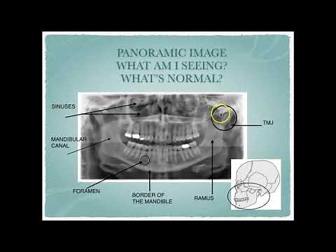 Radiographic Interpretation of Dental Anatomy