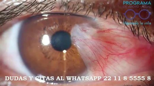 60 reactions | ¡Atención! CHIPILO TERRENATE, se les invita a la gran...