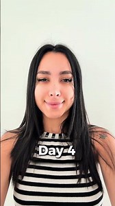 before and after Botox Therapy