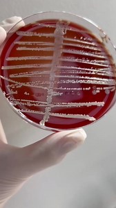 49K views · 948 reactions | Staphylococcus Saprophyticus on Sheep...