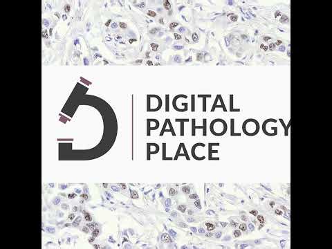 241: Foundation Models in Pathology: Strong on Paper, Ready for Labs?