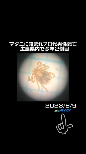 広島県尾道市内に住む70代の男性がマダニによる感染症で死亡しました。今年に入り、県内でのマダニが要因となる死亡は2例目です。\t #広島県 #尾道市 #マダニ #SFTS #重症熱性血小板減少症候群 #70代男性 #TikTokでニュース